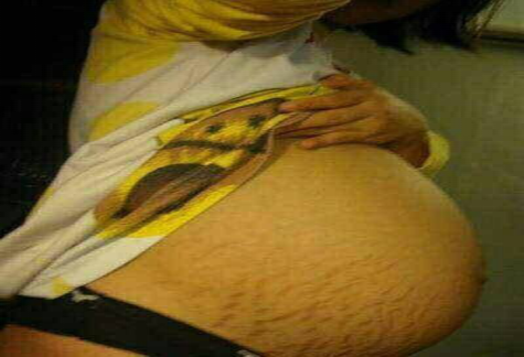 產(chǎn)后恢復 產(chǎn)后恢復