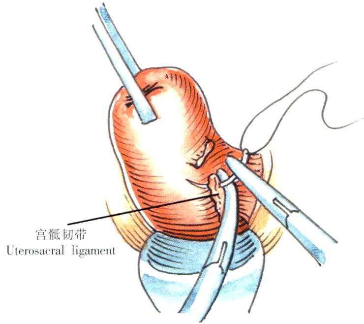 1560568195821318.jpg 產(chǎn)婦產(chǎn)后恢復