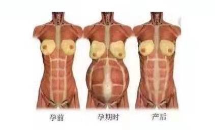 1563416944338694.png 產(chǎn)后康復治療