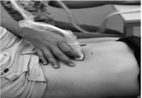 1563517925200642.png 腹直肌治療