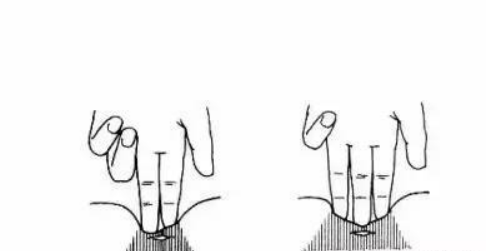 1563863975635387.png 腹直肌分離修復儀器