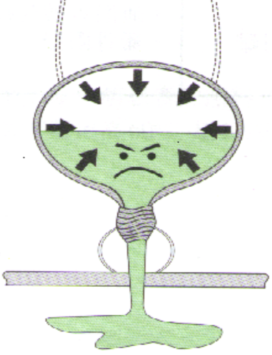 1563956854881708.png 混合型尿失禁