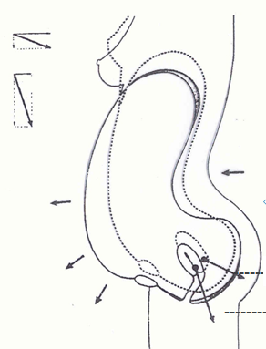 1564040574630561.png 盆底功能障礙