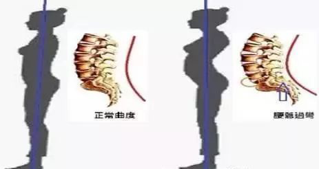 1565248433657461.png 腹直肌分離