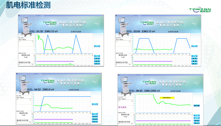 1565667720180612.png 盆底肌修復