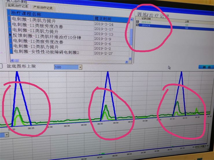 1568863586945482.png 盆底肌修復