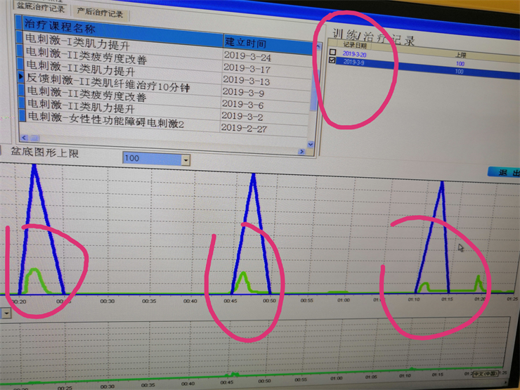 1568863594637852.png 盆底肌檢測