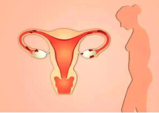 1570497808541721.png 產(chǎn)后恢復(fù)