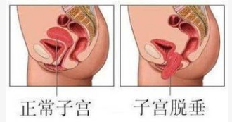 1570498297200144.png 產(chǎn)后康復治療