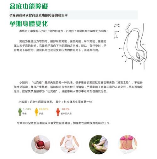 1570863989147805.jpg 盆底康復(fù)治療