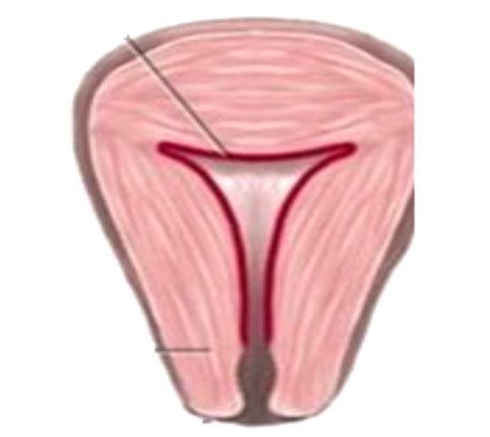 1571714478391289.jpg 子宮復(fù)舊