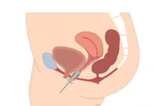 1573545626770894.png 圖片1.png