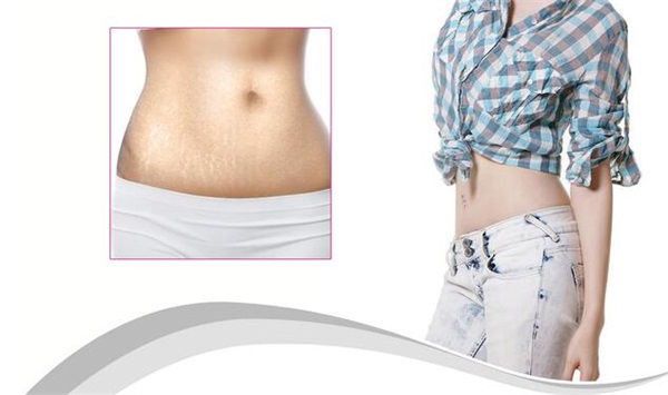 1573632610138518.jpg 產(chǎn)后修復治療