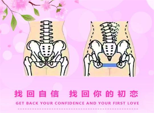 1575879439490009.jpg 產(chǎn)后修復