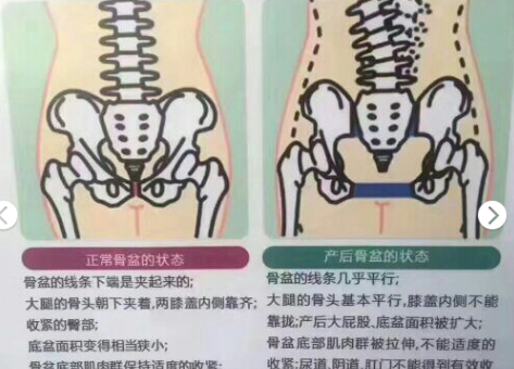 1576571423455986.png 產(chǎn)后修復