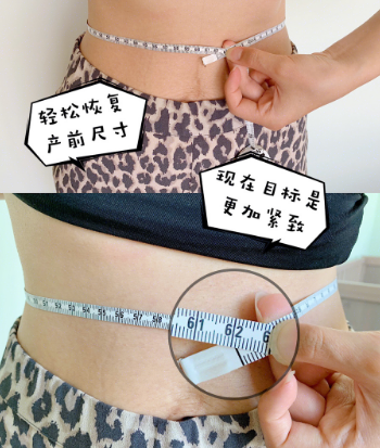 1576655392750172.png 腹直肌修復