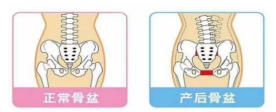 1578291752591981.png 盆底肌修復