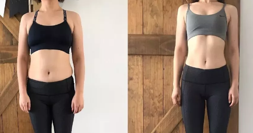 1578367590994702.png 腹直肌分離修復