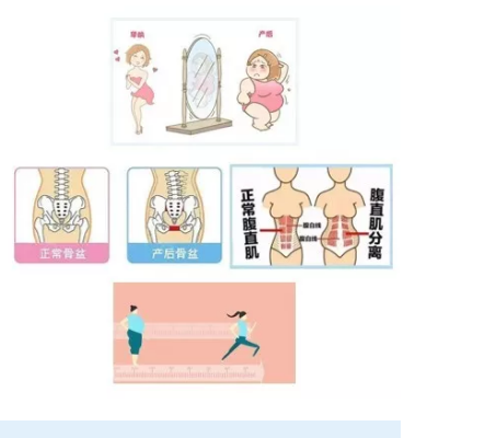 1578462545452290.png 產(chǎn)后恢復