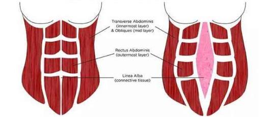 1578981331703709.jpg 腹直肌分離
