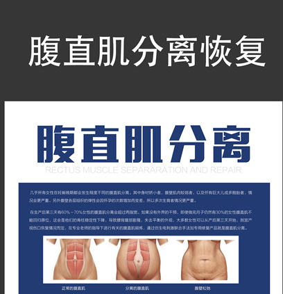 1580872443423294.png 腹直肌修復