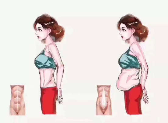 1582851859502310.png 腹直肌修復(fù)