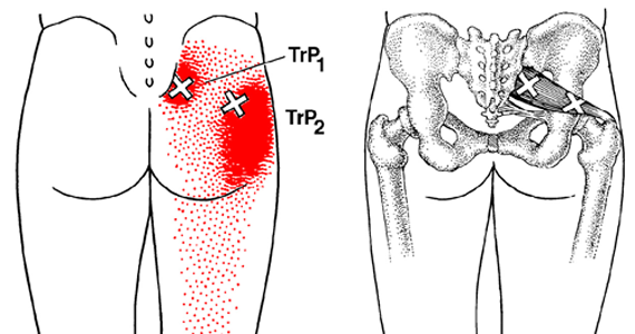 1583975629454693.png 盆底康復治療