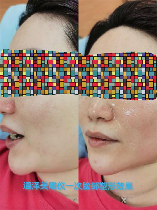 1589787842907542.jpg 塑形儀器.jpg