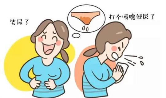 盆底康復治療儀 盆底康復治療儀