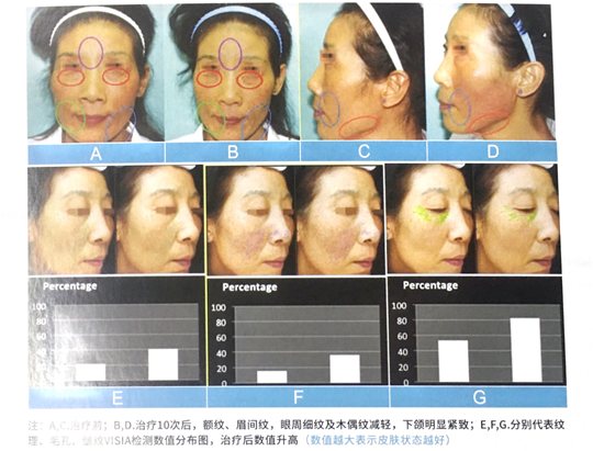 1602317715128211.png 4.png