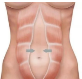 1602553318599940.png 產(chǎn)后康復