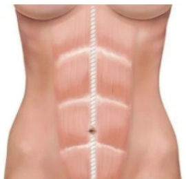 1602553324641153.png 產(chǎn)后修復