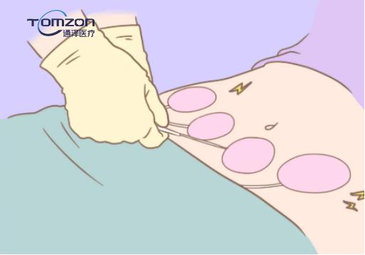 盆底肌修復儀器 盆底肌修復儀器