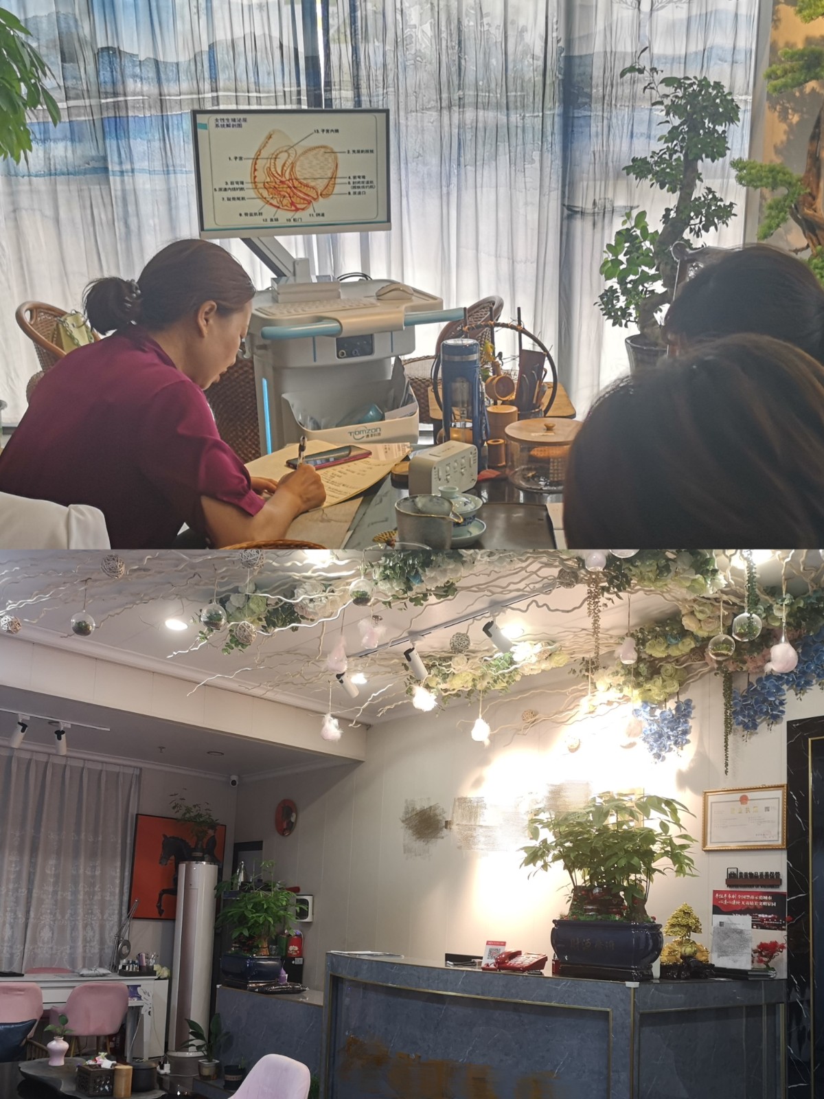 盆底康復治療儀 盆底康復治療儀