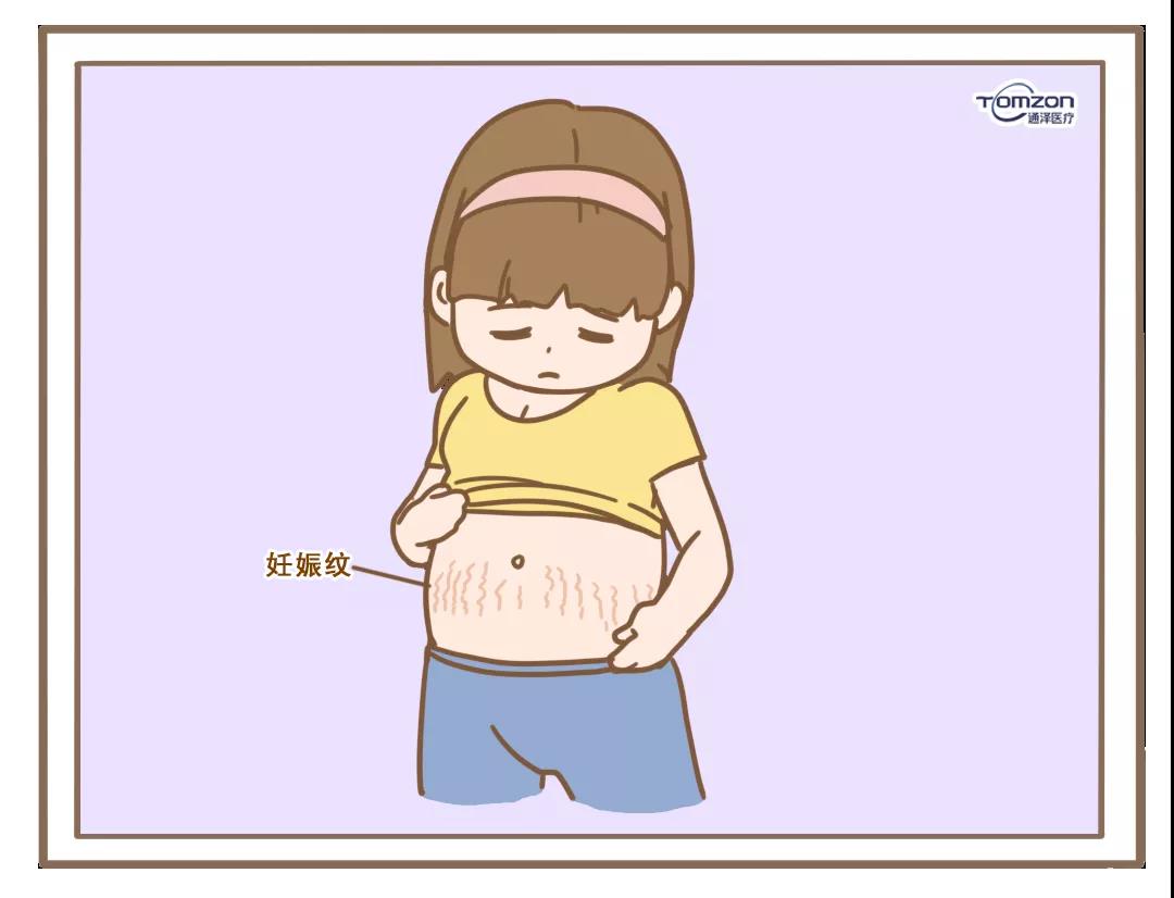 盆底康復 盆底康復