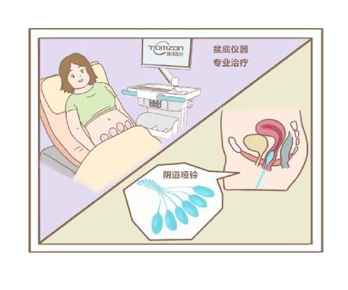 盆底肌修復儀器.jpg 盆底肌修復儀器.jpg