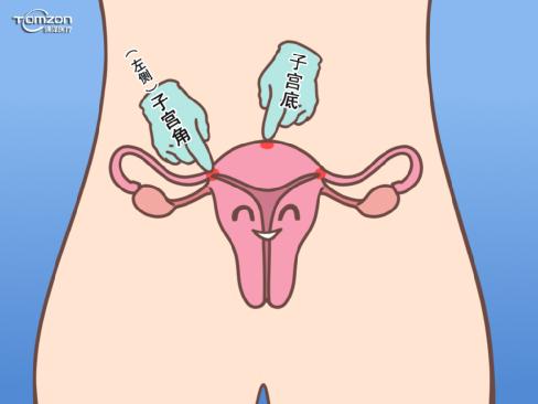 盆底肌修復儀器.jpg 盆底肌修復儀器.jpg