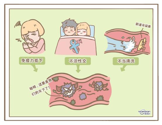 盆底康復治療儀 盆底康復治療儀