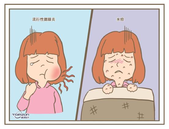 盆底康復治療儀 盆底康復治療儀